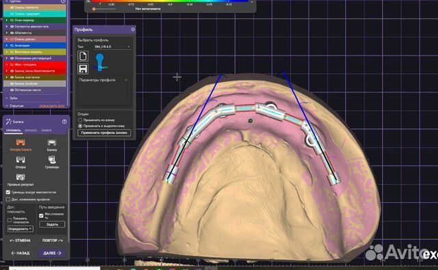 Зубной техник cad Cam